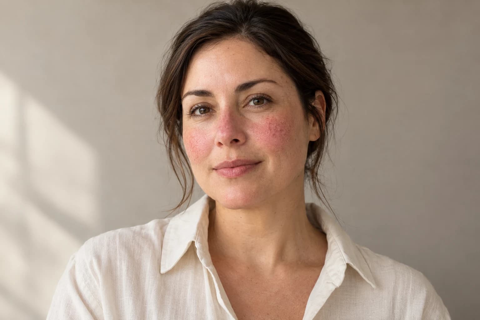 Retrato de una mujer adulta con enrojecimiento visible en las mejillas y la nariz, sin retoque que oculte la textura de la piel.